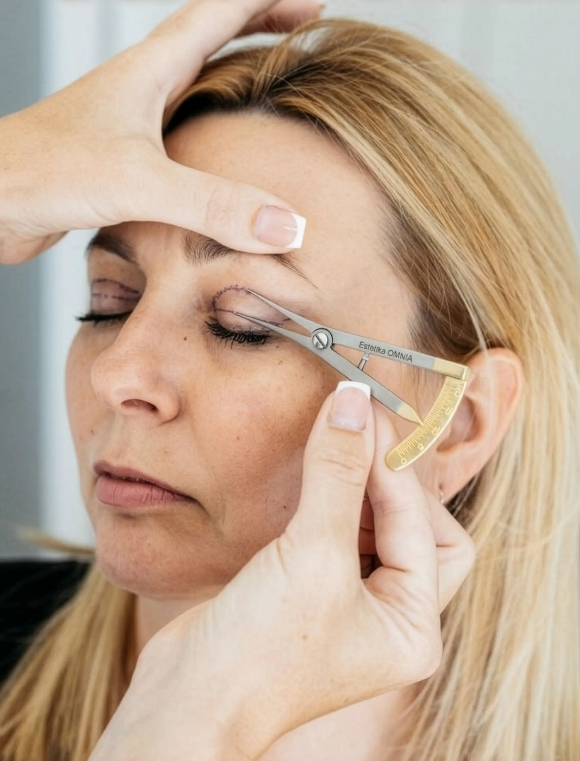 Blefaroplastika